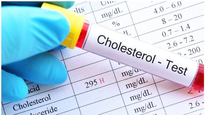 five healthy nuts that lower bad cholesterol levels five healthy nuts that lower bad cholesterol levels