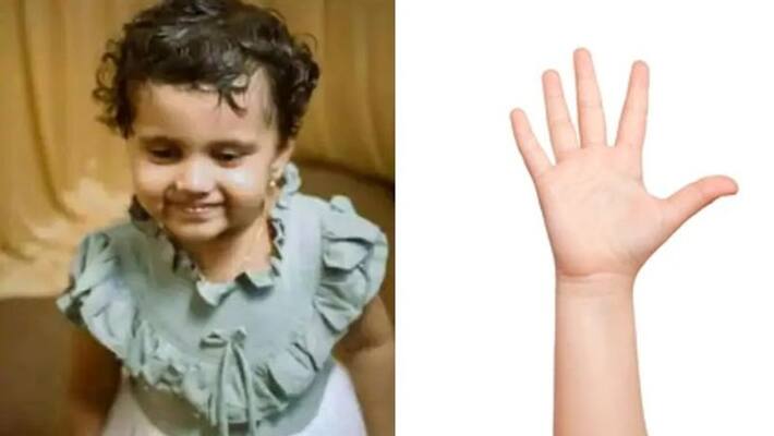 baby died after swallowing bottle cap and parents should know why these kind of incidents repeats baby died after swallowing bottle cap and parents should know why these kind of incidents repeats
