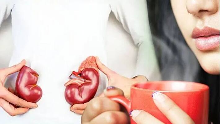 Identify Kidney Failure from Urine Colour Identify Kidney Failure from Urine Colour