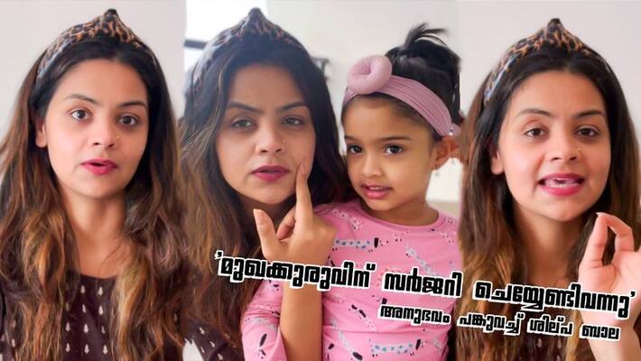 Shilpa bala shared video story about skin surgery goes viral Shilpa bala shared video story about skin surgery goes viral