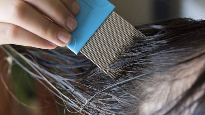video in which hairdresser shows girls head full of lice video in which hairdresser shows girls head full of lice