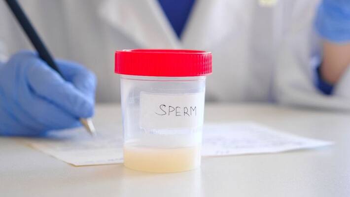Yellow Colour Sperm What does it mean Yellow Colour Sperm What does it mean
