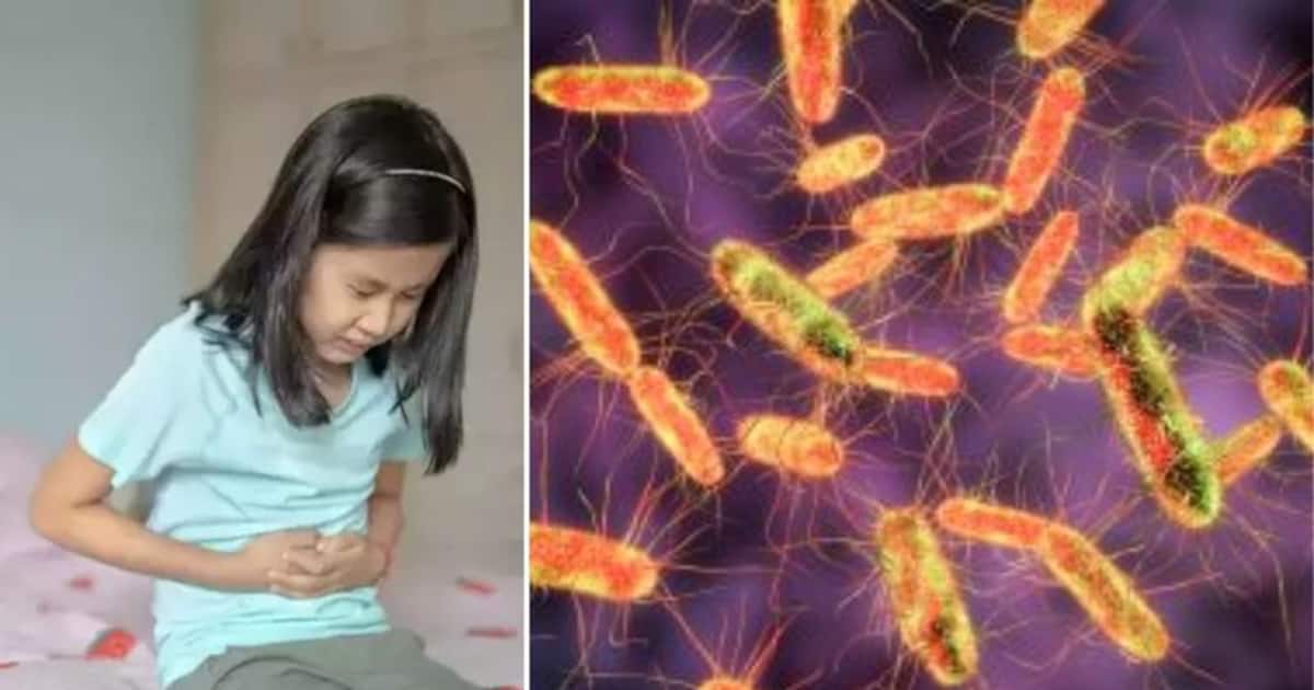 Salmonella outbreak சாக்லெட் சாப்பிடுவதால் பரவும் சால்மோனெல்லா நோய்