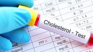 how to lower high cholesterol without medicine