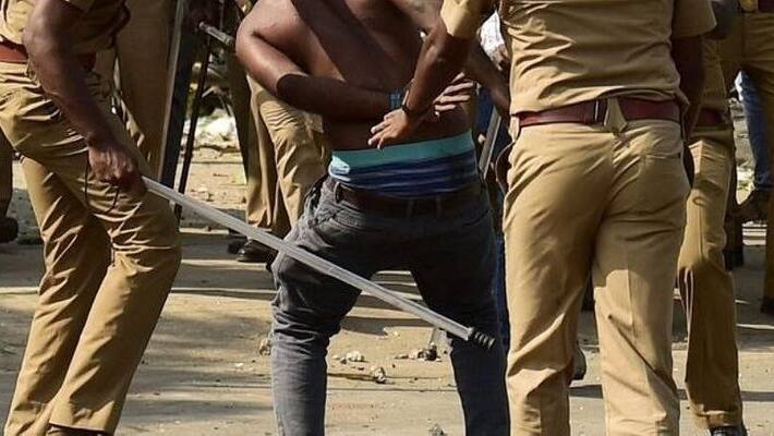 Torture by giving current shock in the penis in the name of investigation .. UP police Atrocity. Torture by giving current shock in the penis in the name of investigation .. UP police Atrocity.