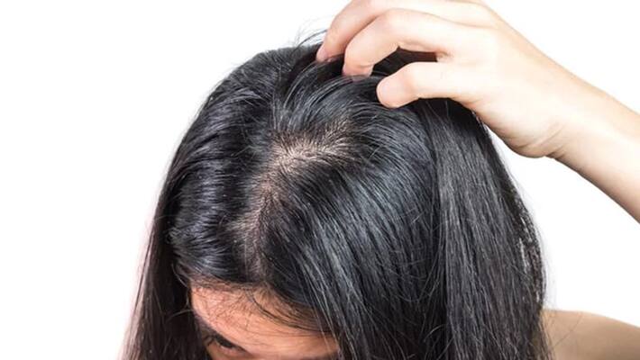 Use those 3 home made hair mask to solve scalp problems ABSC Use those 3 home made hair mask to solve scalp problems ABSC