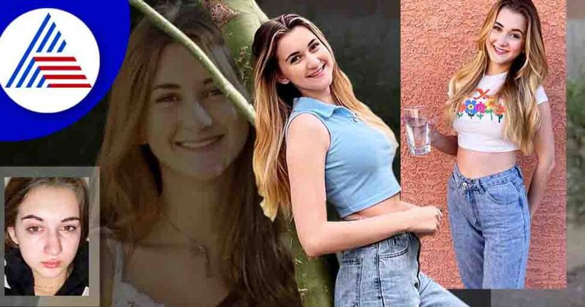 ಈಕೆಗೆ ನೀರೆಂದರೇ ಅಲರ್ಜಿ, ಕುಡಿದರೆ ವಾಂತಿಯಾಗುತ್ತೆ, ಕಣ್ಣೀರು ಹಾಕಿದರೆ ಆಸಿಡ್