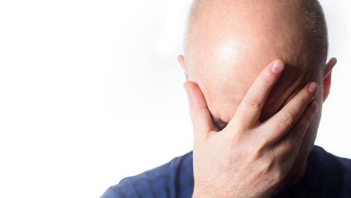 Tips for men to solve hair fall problems quickly ABSC Tips for men to solve hair fall problems quickly ABSC