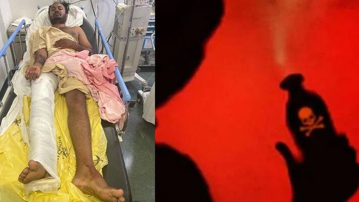 Police Firing On Bengaluru Acid Attack Accused Nagesh who Trued To Escape pod Police Firing On Bengaluru Acid Attack Accused Nagesh who Trued To Escape pod
