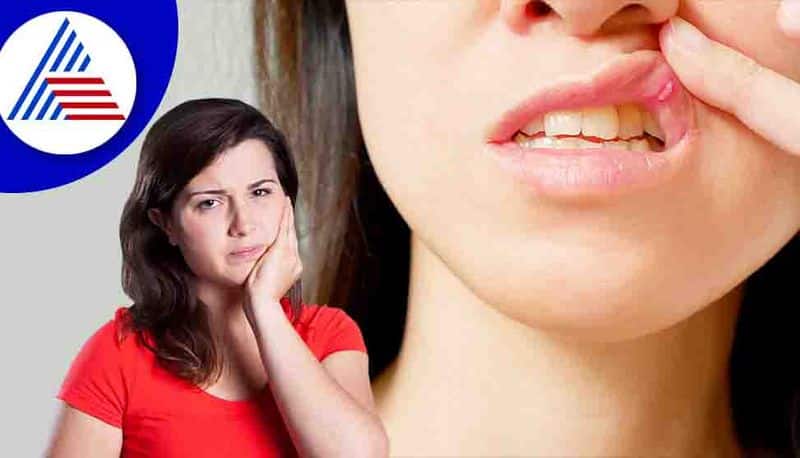 frequent mouth sores may also indicate malnutrition and immune deficiency