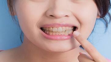 top 5 ayurvedic home remedies to remove yellow stains from teeth in tamil mks top 5 ayurvedic home remedies to remove yellow stains from teeth in tamil mks