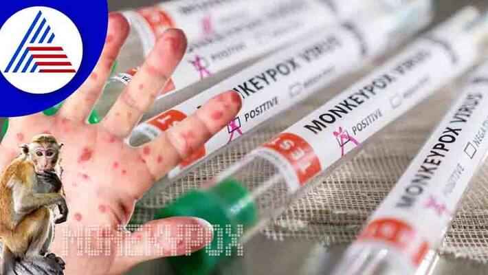 Indias First Monkeypox Patient Recoversd Vin Indias First Monkeypox Patient Recoversd Vin