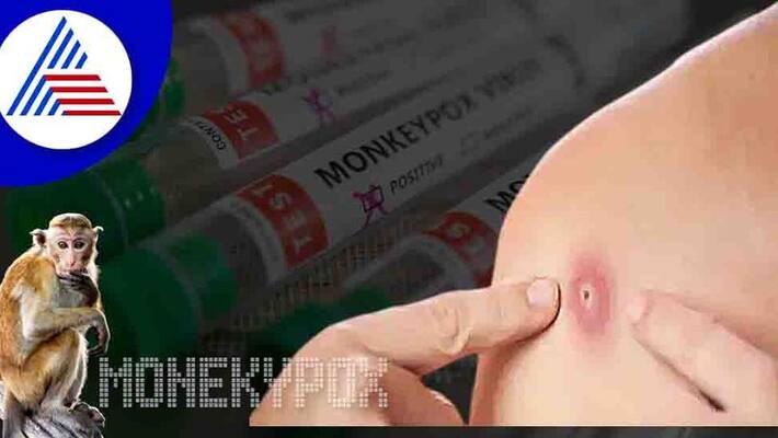257 people in 23 countries are affected by Monkeypox WHO alert to countries around the world 257 people in 23 countries are affected by Monkeypox WHO alert to countries around the world