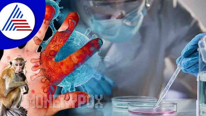 Suspected Monkeypox virus found in 8 year old boy reports Andhra Pradesh ckm Suspected Monkeypox virus found in 8 year old boy reports Andhra Pradesh ckm