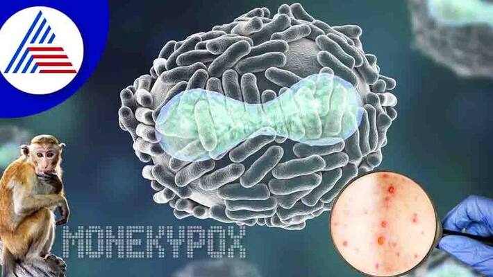 22 year old woman infected monkeypox in Delhi with no travel history India count gone up to 10 ckm 22 year old woman infected monkeypox in Delhi with no travel history India count gone up to 10 ckm