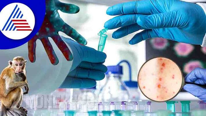Kerala Youth died in Thrissur after test monkeypox positive in UAE Health Minister order high level probe ckm Kerala Youth died in Thrissur after test monkeypox positive in UAE Health Minister order high level probe ckm