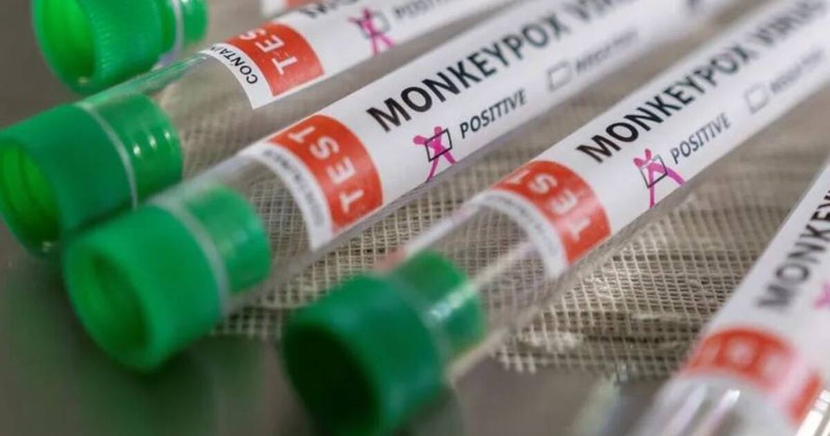 லேசான அறிகுறிகள்... இந்தியாவில் ஐந்து வயது சிறுமிக்கு குரங்கு அம்மை பரிசோதனை..!