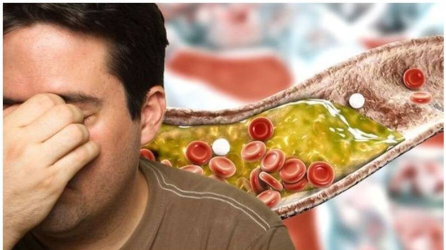 High Cholesterol: These everyday foods will help keep it under control rsl High Cholesterol: These everyday foods will help keep it under control rsl
