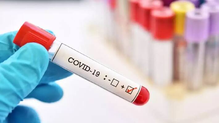 107 got corona positive today in tamilnadu 107 got corona positive today in tamilnadu