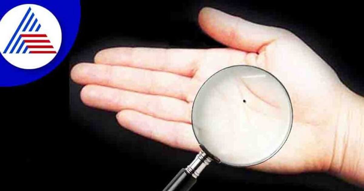 இந்த அபூர்வ மச்சம் இருந்தால், அவர் கோடீஸ்வரர்! நவகிரக மச்சங்களும் அவற்றின் பலன்களும்.. 