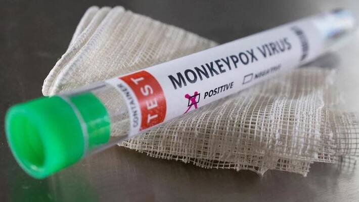 Saudi Arabia reports first monkeypox case Saudi Arabia reports first monkeypox case
