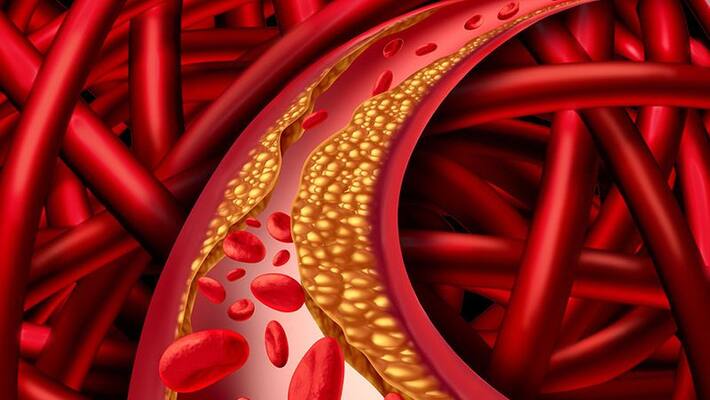 this tips will help you to control your ldl and improve your hdl cholesterol this tips will help you to control your ldl and improve your hdl cholesterol