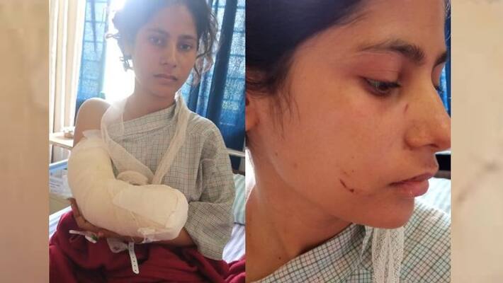 Police have arrested Renu s husband for cutting off his wife s wrist in Ketugram RTB Police have arrested Renu s husband for cutting off his wife s wrist in Ketugram RTB