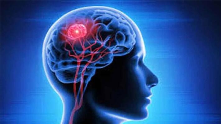Simple ways to sharpen the brain you should know this BDD Simple ways to sharpen the brain you should know this BDD