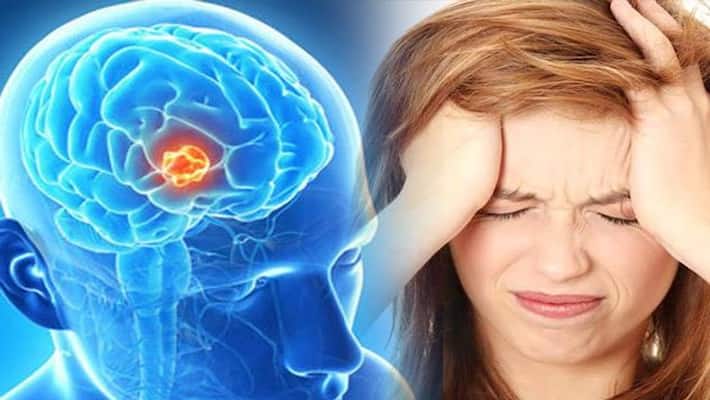 Sometimes headache can be fatal, know the symptoms of brain cancer here bpsb Sometimes headache can be fatal, know the symptoms of brain cancer here bpsb