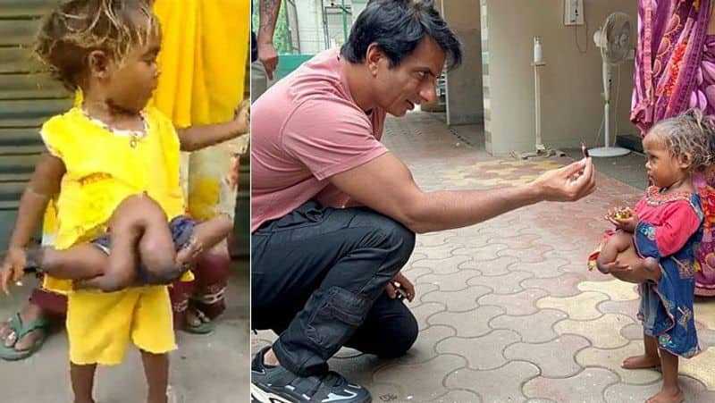 Sonu Sood helps Bihar girl who was born with 4 legs and 4 arms social media viral