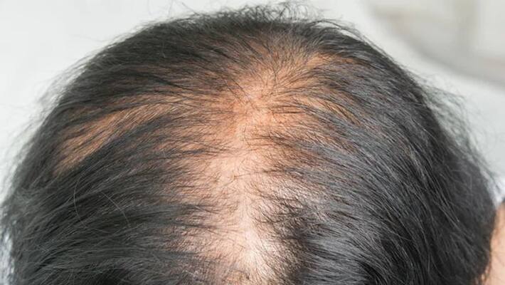 scientist developed mature hair growth in vitro soon cure of baldness NTP scientist developed mature hair growth in vitro soon cure of baldness NTP