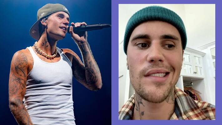 Singer Justin Bieber affected by rare syndrome which causes face Paralysis Singer Justin Bieber affected by rare syndrome which causes face Paralysis