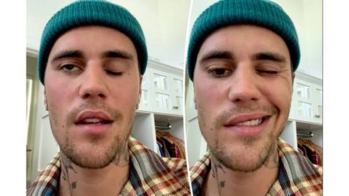 Justin Bieber is suffering from facial paralysis due to Ramsay hunt syndrome anbsd Justin Bieber is suffering from facial paralysis due to Ramsay hunt syndrome anbsd