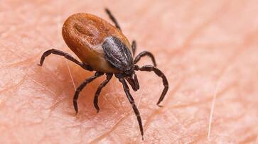 Scrub Typhus outbreak claims 5 lives in Odisha: Know causes, symptoms and prevention AJR Scrub Typhus outbreak claims 5 lives in Odisha: Know causes, symptoms and prevention AJR