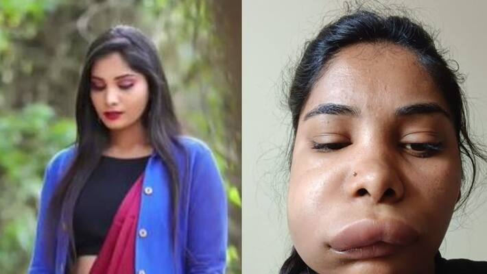 Swathi Sathish: ಸ್ಯಾಂಡಲ್​ವುಡ್​ ನಟಿ ಪಾಲಿಗೆ ವಿಲನ್ ಆದ ದಂತ ವೈದ್ಯೆ