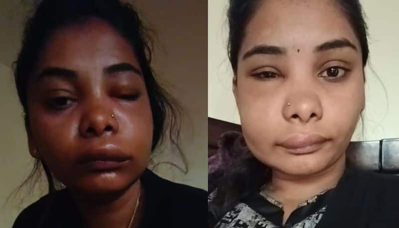 Actress swathi sathish gets swollen face after dental treatment gone wrong