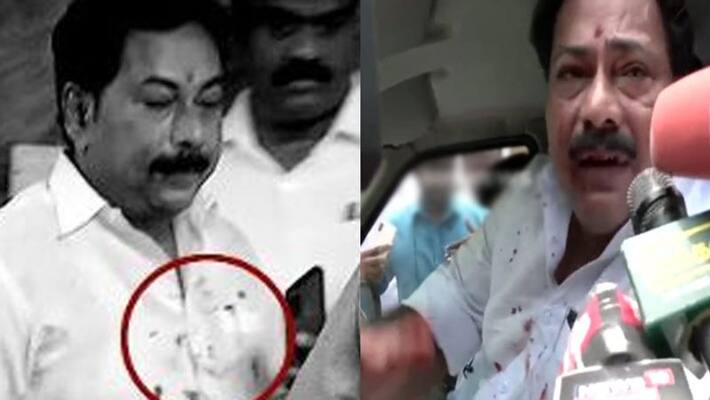 Attack on EPS supporter in chennai Attack on EPS supporter in chennai
