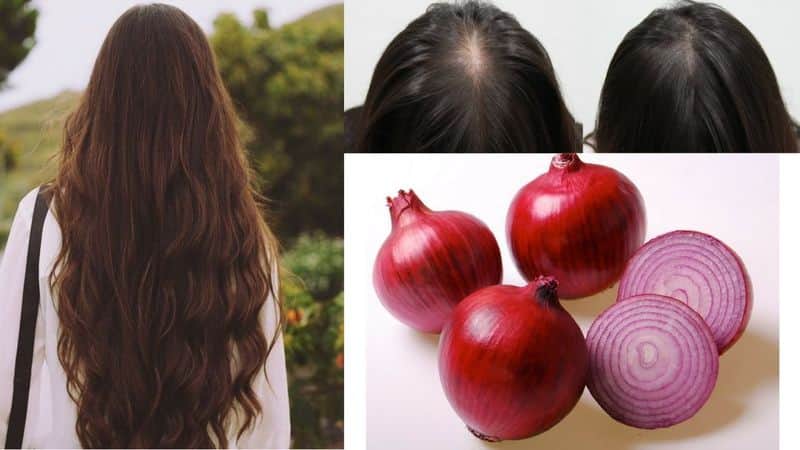 Benefits of Onion for Hair Mask that makes hair shine and healthy