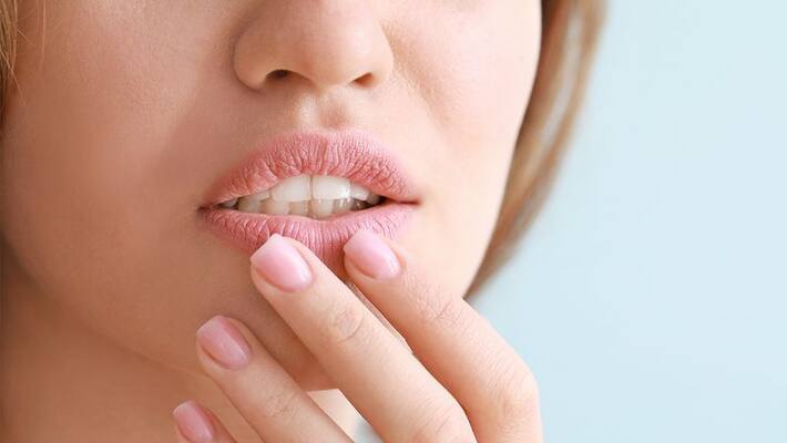 Follow those tips if facing Lip crack problem in summer ABSC Follow those tips if facing Lip crack problem in summer ABSC