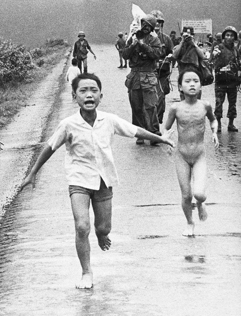 Napalm Girl gets final burn treatment in US 50 years later 