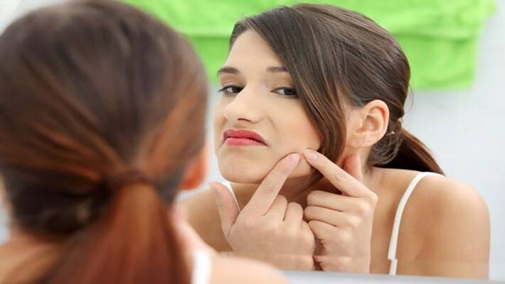 Use those home remedies only 2 time in a week to solve acne problems ABSC Use those home remedies only 2 time in a week to solve acne problems ABSC