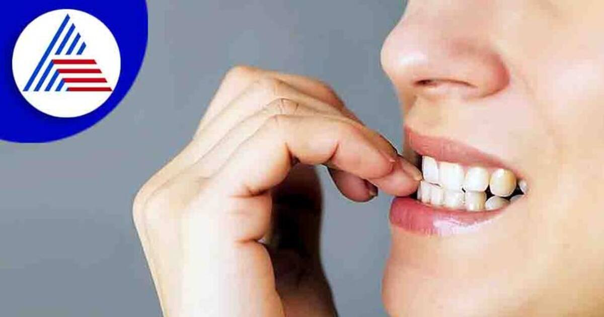 Nails Biting : நீங்கள் அடிக்கடி நகம் கடிப்பீர்களா? இது ஆபத்தான பழக்கம்...ஜாக்கிரதை..!!