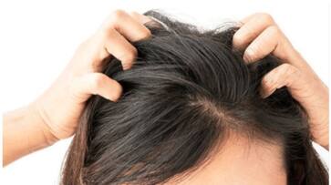 how can we avoid head lice completely hyp how can we avoid head lice completely hyp