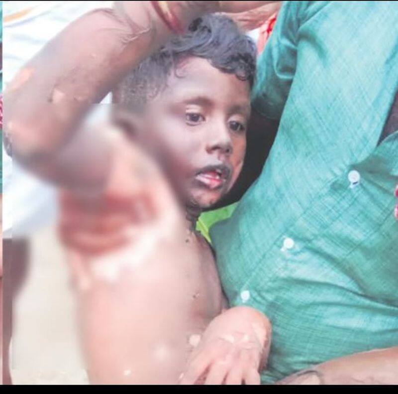 In Tirupati, the father burnt the child due to a problem with his wife.