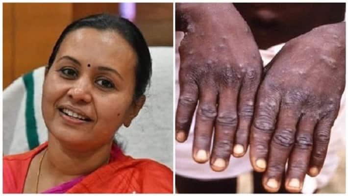 suspected monkeypox death in thrissur health minister veena george says high level team will investigate suspected monkeypox death in thrissur health minister veena george says high level team will investigate