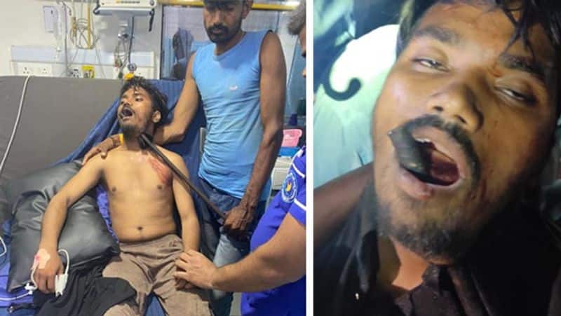 Bhopal Man Fell From Roof Iron Bar Stuck In The Neck Shocking Picture Goes Viral pod
