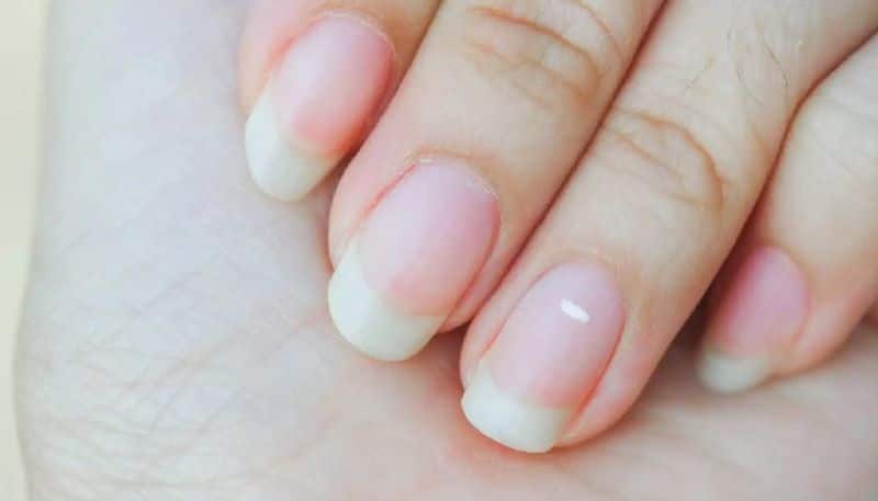 A Look At Your Nails Can Tell If You Have A Life Threatening Disease!