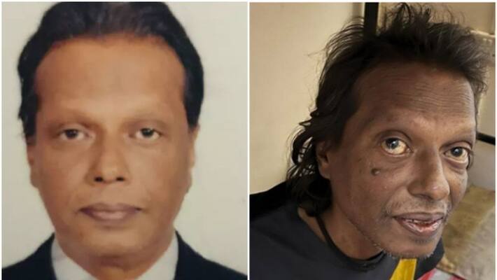 Shaji ramesh a stranded malayali expat who was in critical condition in UAE died at 55 Shaji ramesh a stranded malayali expat who was in critical condition in UAE died at 55