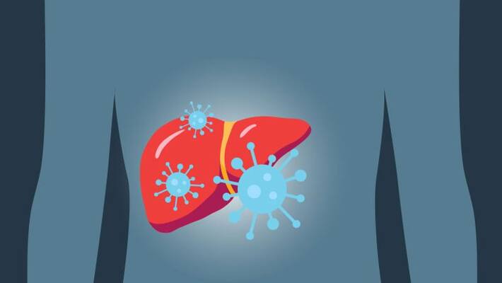world hepatitis day 2022 dont ignore these symptoms of viral hepatitis world hepatitis day 2022 dont ignore these symptoms of viral hepatitis
