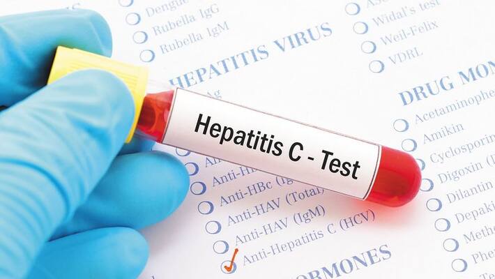 world hepatitis day 2022 hepatitis c diet foods to eat and avoid world hepatitis day 2022 hepatitis c diet foods to eat and avoid